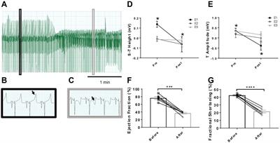 Impaired Baroreflex Function in an Ovine Model of Chronic Heart Failure Induced by Multiple Coronary Microembolizations